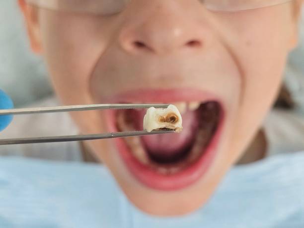 Professional Emergency Dentist in GA
